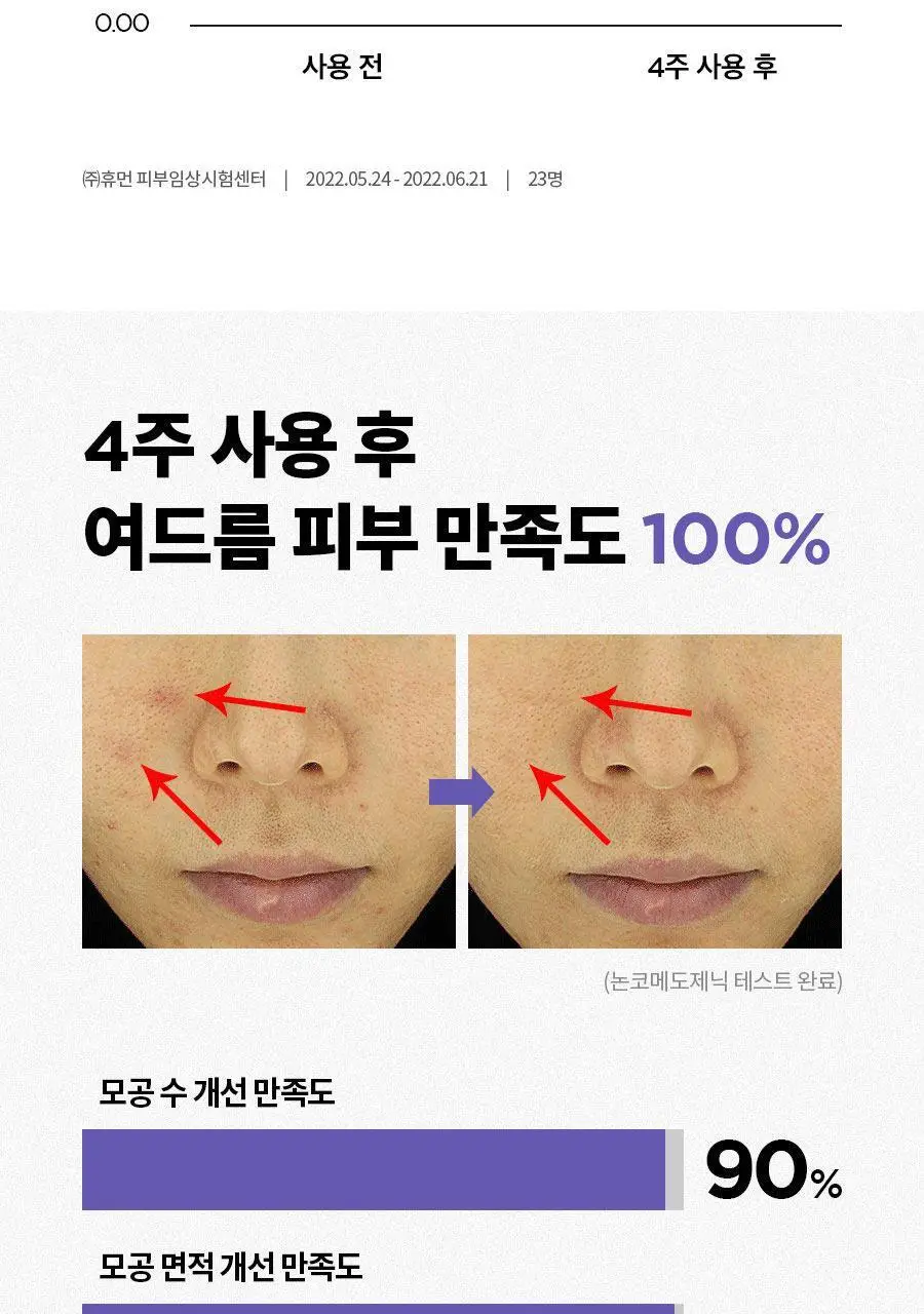[NCT 재민PICK] 이즈앤트리 어니언 뉴페어 클리어 패드 60매 (+20매 리필 증정기획) 상세페이지 31